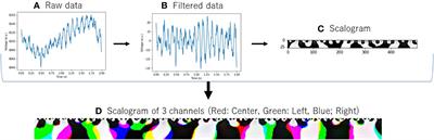 Utilizing portable electroencephalography to screen for pathology of Alzheimer’s disease: a methodological advancement in diagnosis of neurodegenerative diseases